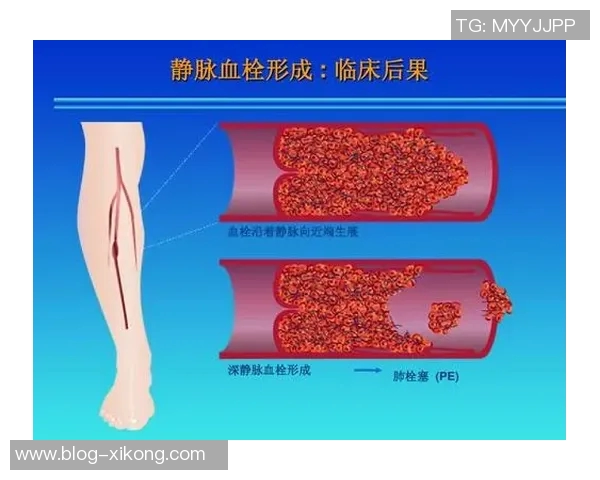 文班谈血栓伤病的医学分析与心理状态的积极应对